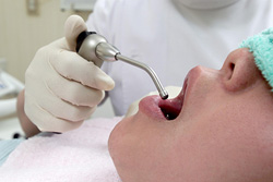 お口の健康を守る秘訣は予防歯科